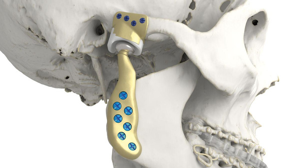 Ghent Workgroup zoekt expertise in 3D-printen 