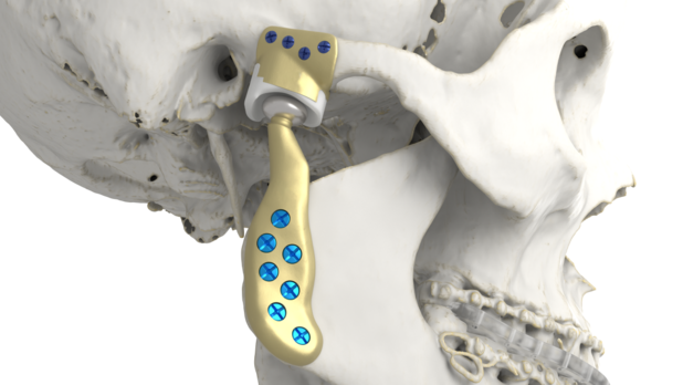 Ghent Workgroup zoekt expertise in 3D-printen